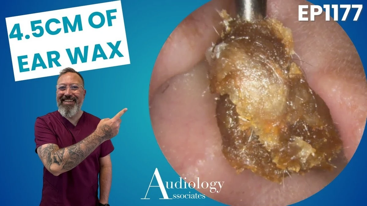 Máslo na skleničce od svíčky: nejoddajnější způsob, jak ji odstranit - image 1